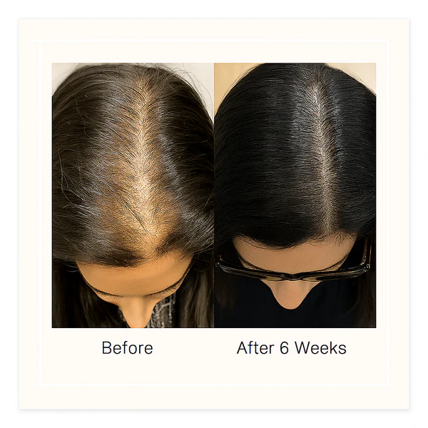 Be Bodywise Advanced Hair Growth Roll-On Serum | 3% Rosemary | 2% Aminexil | 3% Redensy l 2% Anagain | Precision Scalp Applicator | Paraben & Sulphate Free | Non oily and mess free