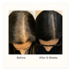 Be Bodywise Advanced Hair Growth Roll-On Serum | 3% Rosemary | 2% Aminexil | 3% Redensy l 2% Anagain | Precision Scalp Applicator | Paraben & Sulphate Free | Non oily and mess free